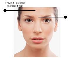 Affordable Botox in Fethiye