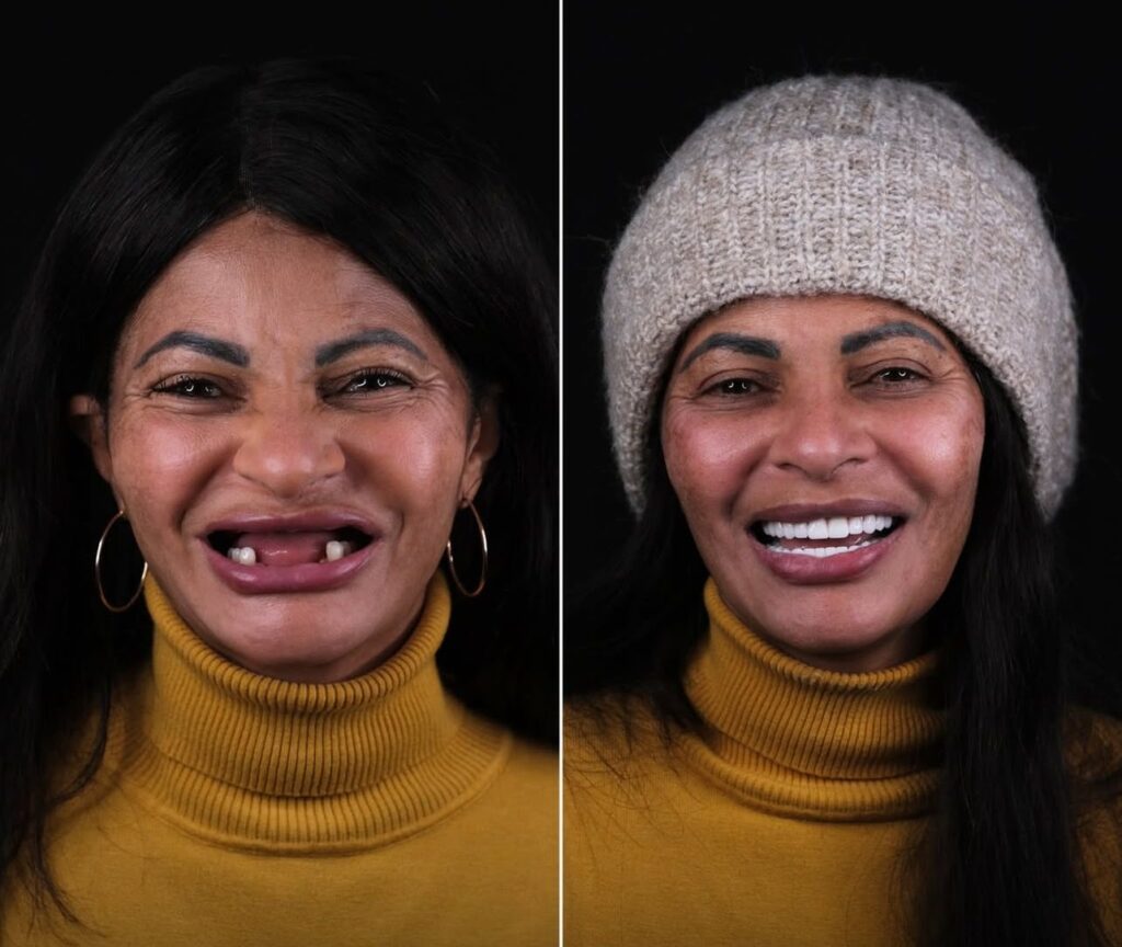 Dental Treatments Fethiye Prices 2026