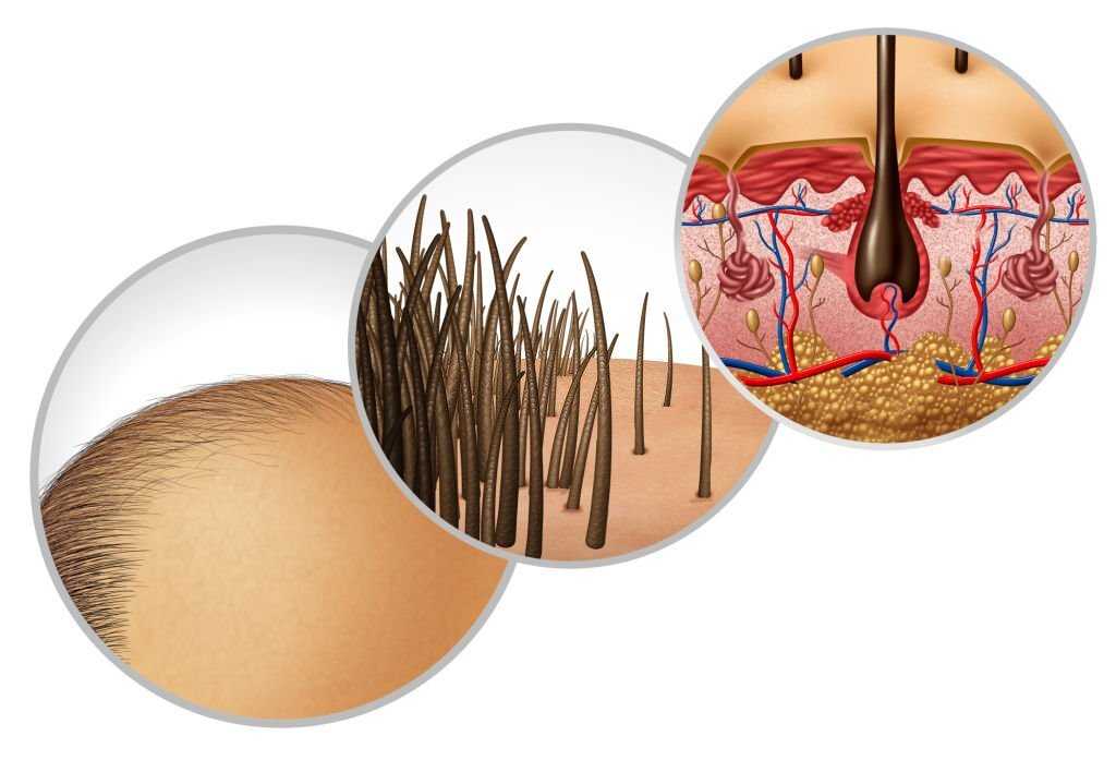 Hair Transplant Fethiye