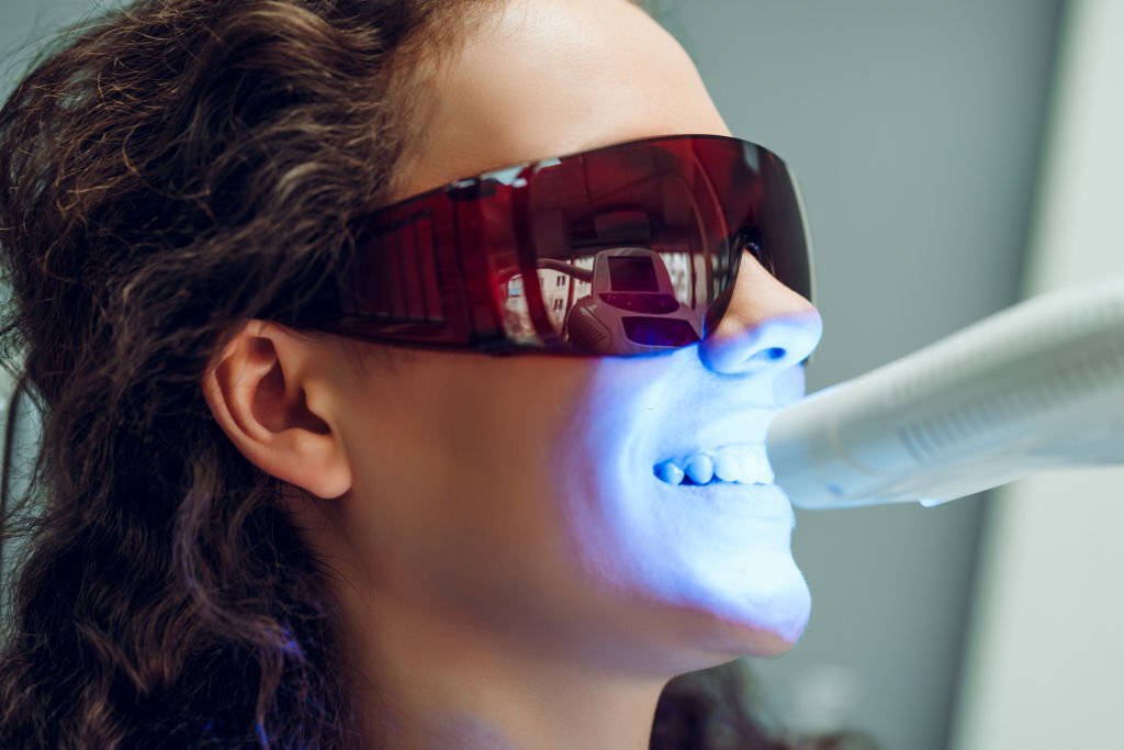 Laser Teeth Whitening Fethiye