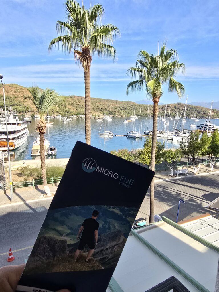 Best Time for Dental Treatments in Fethiye