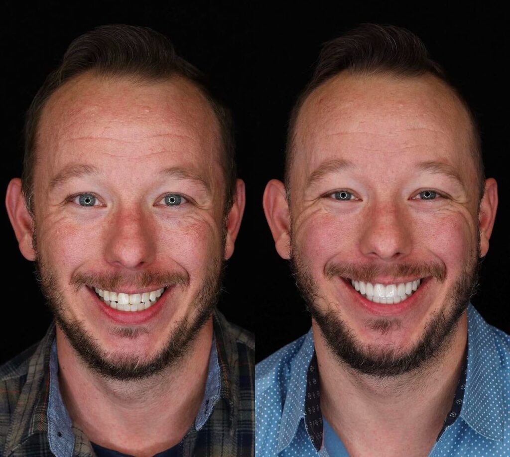 Best Time for Dental Treatments in Fethiye